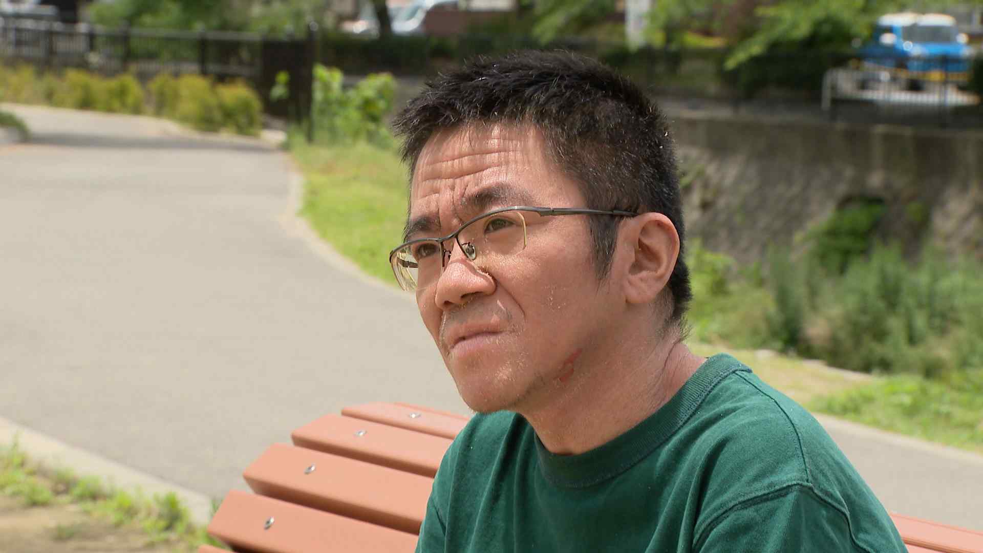 「理解してくれる人は、必ずいる」皮膚の難病“魚鱗癬”の青年 幸せの日を迎えて決意 RKBオンライン