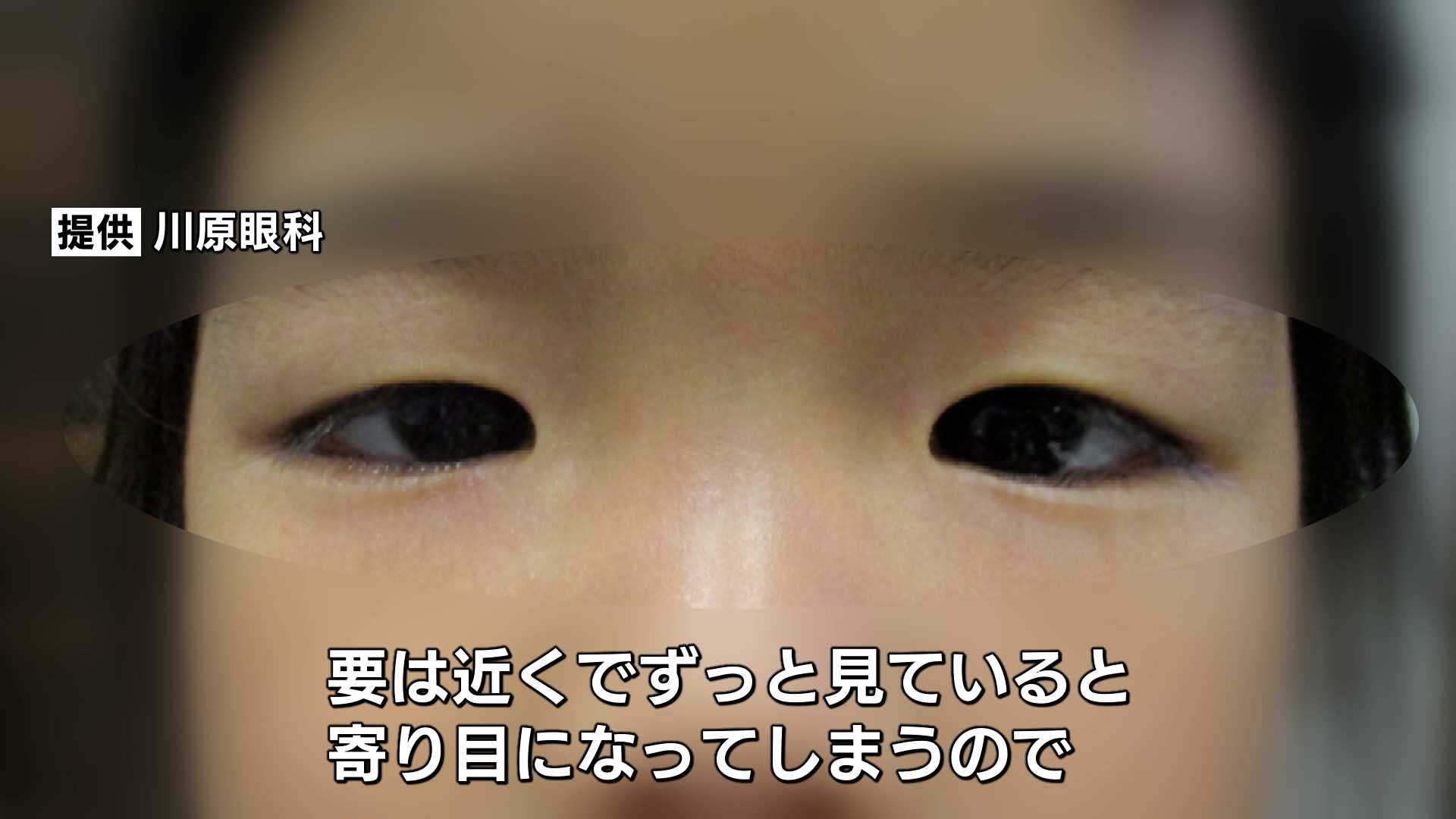 スマホ 見 過ぎ 目